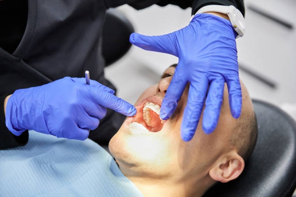 Best Emergency Treatment for Toothache in Clyde, OH